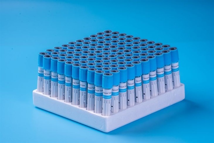 OEM Service 2ml 3ml 4ml 6ml 7ml 10ml Blue Cap 3.2% Sodium Citrate PT Tube